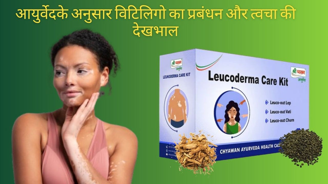 Ayurvedic Treatment for Vitiligo