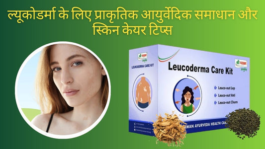 Ayurvedic Treatment for Leucoderma