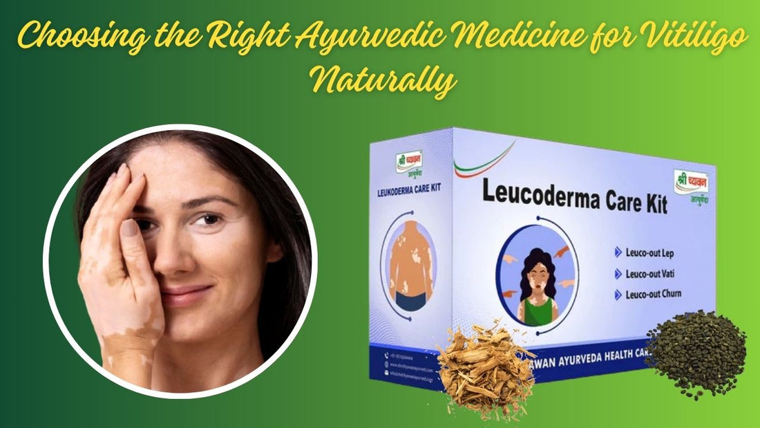 Best ayurvedic medicine for vitiligo