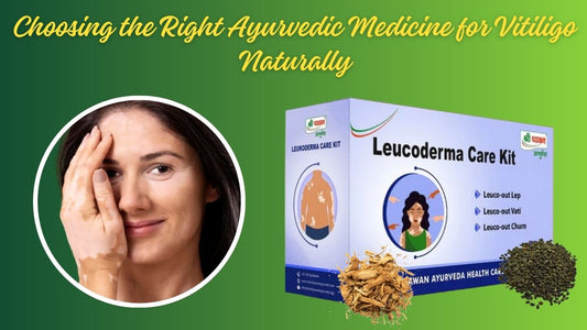 Best ayurvedic medicine for vitiligo