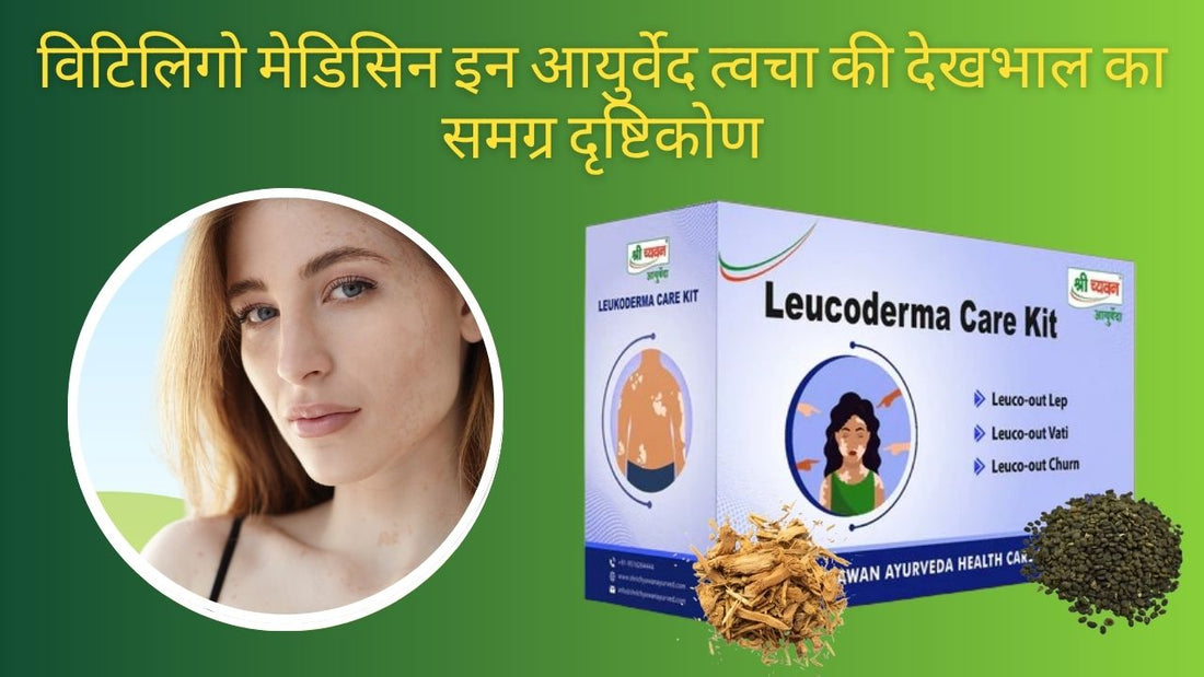 ayurvedic medicine for leucoderma