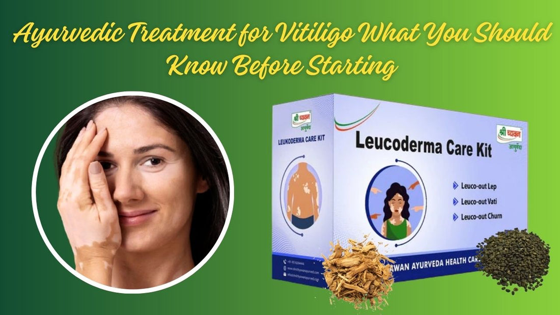 Best ayurvedic treatment for vitiligo