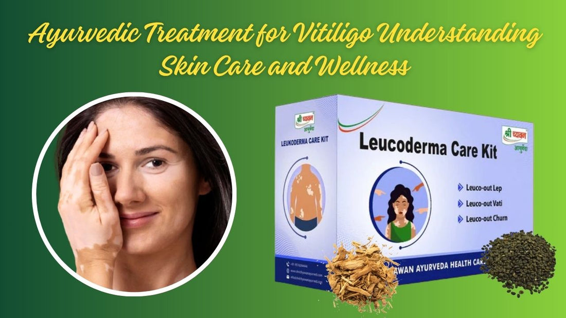 Vitiligo ayurvedic treatment