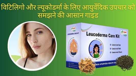 leucoderma ayurvedic treatment