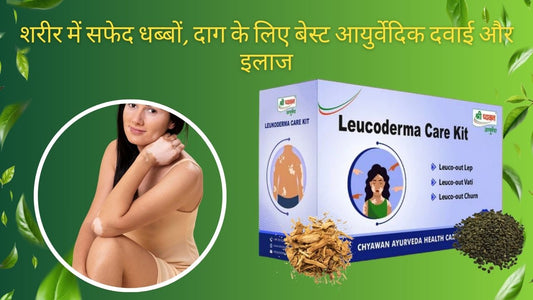 ayurvedic treatment for safed daag
