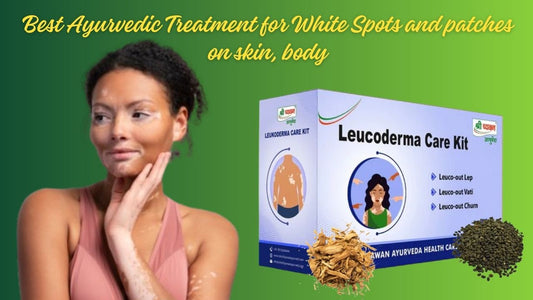 ayurvedic treatment for white patches on skin