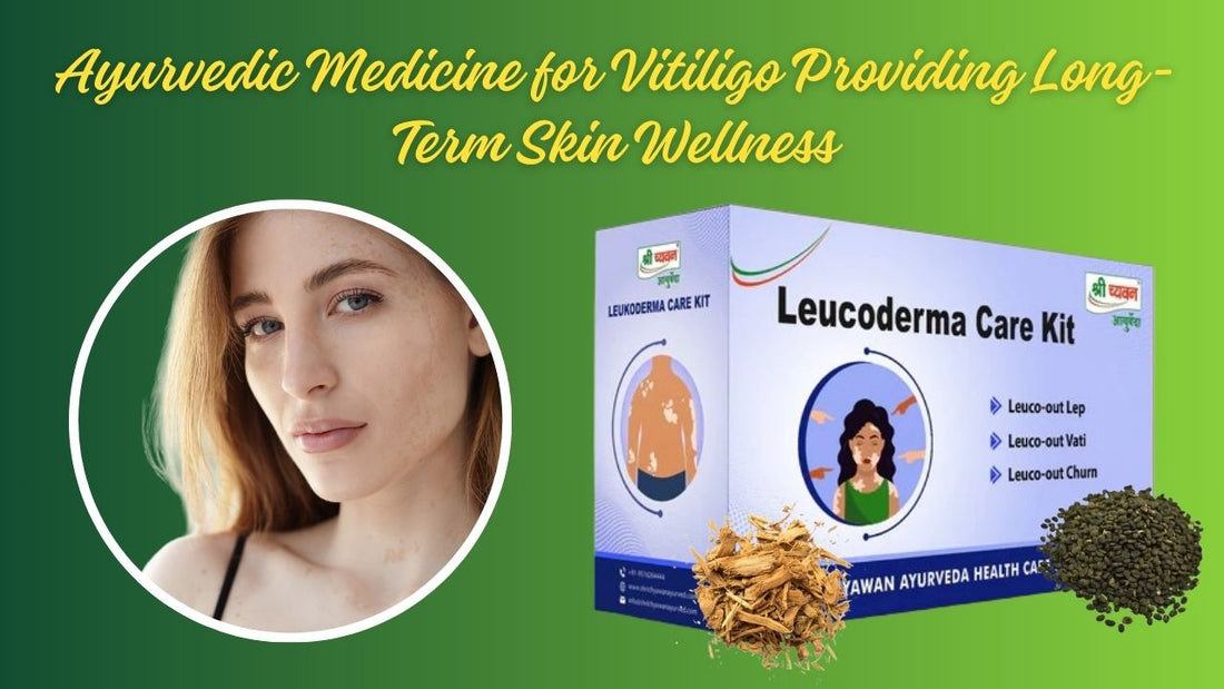 best ayurvedic medicine for vitiligo