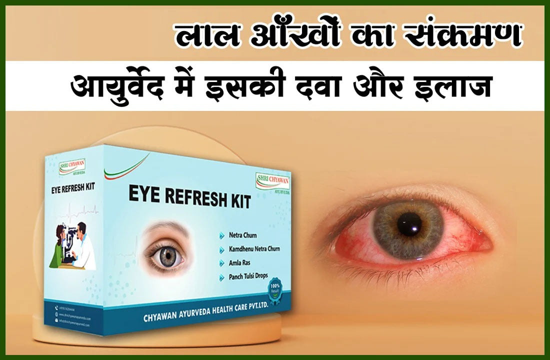 कंजंक्टिवाइटिस या लाल आंखों का संक्रमण क्या है? जानिए आयुर्वेद में इसकी दवा और इलाज
