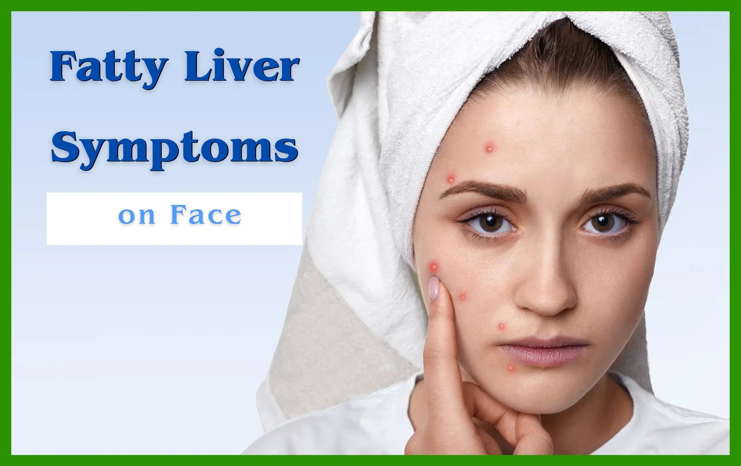 Fatty Liver Symptoms On Face Blog Fatty liver symptoms on face blog