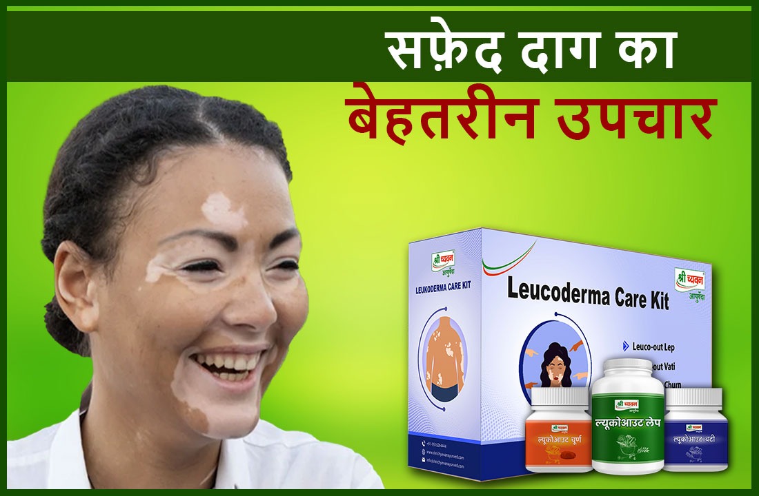 Leucoderma Care Kit से Safed Daag का  सबसे बढ़िया इलाज, बिना किसी Side Effect के