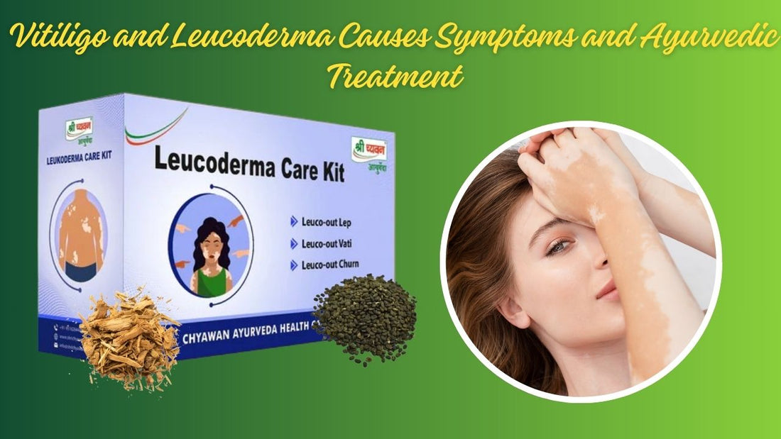 leucoderma and vitiligo treatment