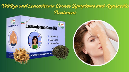 leucoderma and vitiligo treatment