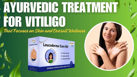 vitiligo ayurvedic treatment