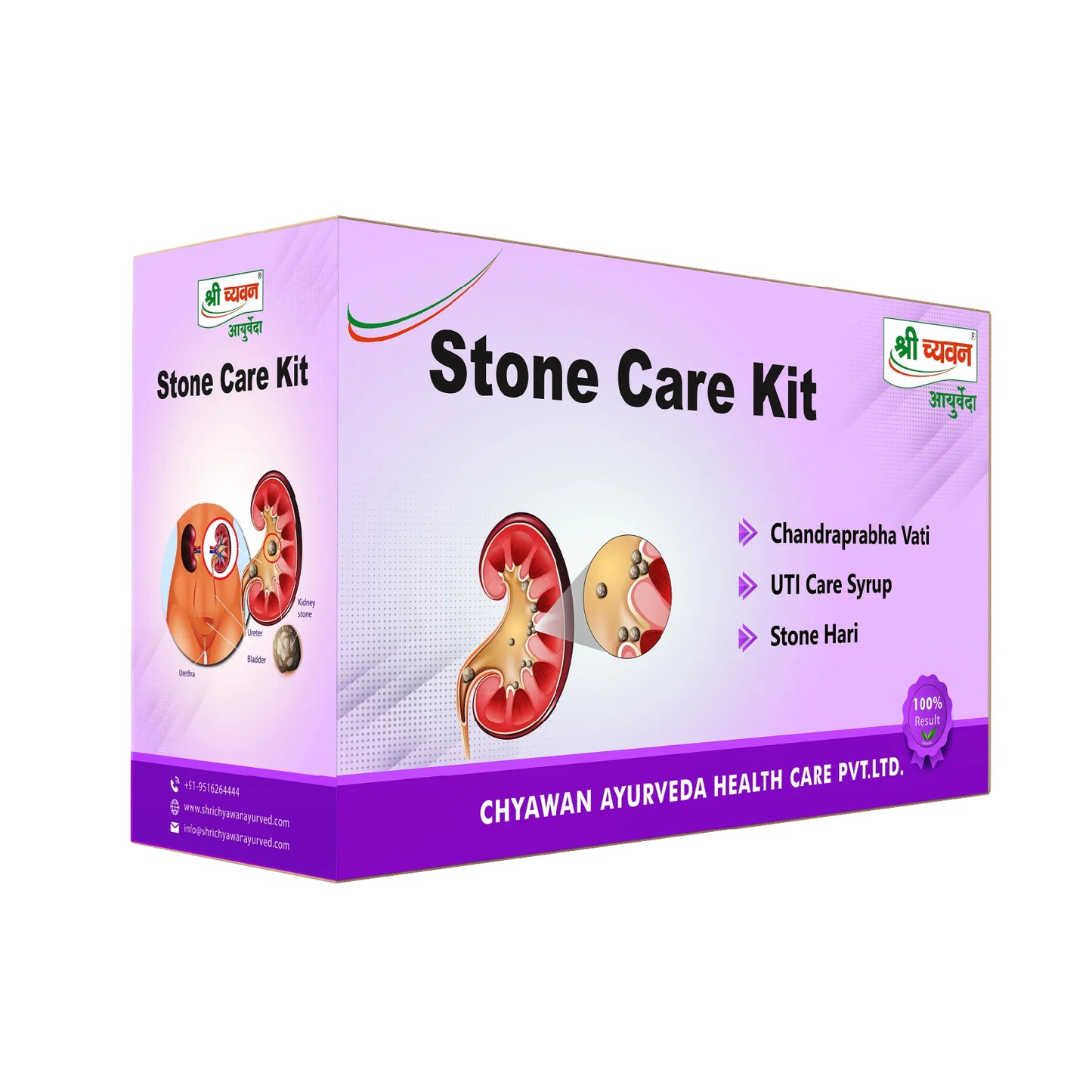 Stone care kit for kidney stone
