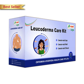 ayurvedic medicine for vitiligo
