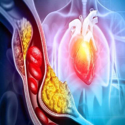 Supports Healthy Cholesterol Levels