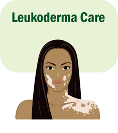 Leukoderma Care