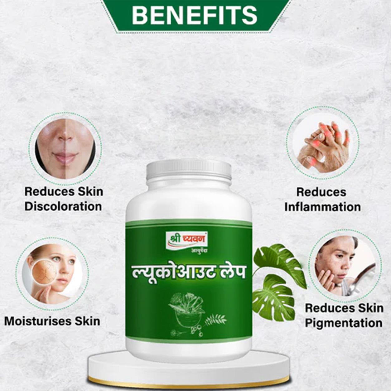 Ayurvedic Treatment for Vitiligo