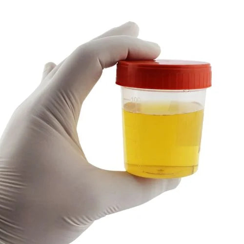 Helps in clearing up cloudy urine.
